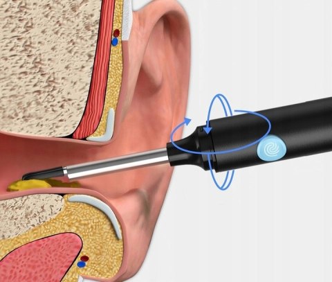 Urządzenie do czyszczenia Inteligenty Otoskop Endoskop Uszu KAMERA HD